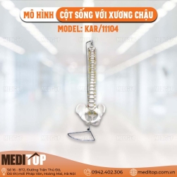 Mô hình cột sống với xương chậu