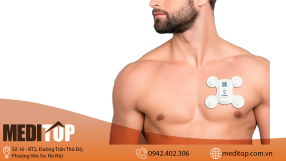 Holter điện tâm đồ là gì? Máy Holter điện tâm đồ và vai trò quan trọng trong chẩn đoán rối loạn nhịp tim