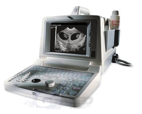 Máy siêu âm sản khoa xách tay 1 đầu dò