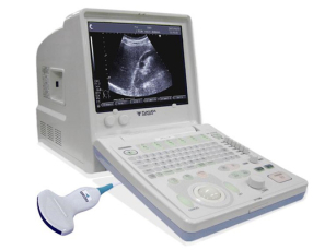 Những điều cần biết về máy siêu âm đen trắng