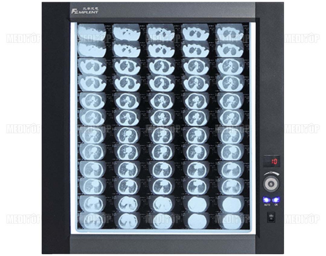 Máy đọc phim X-Quang 1 phim