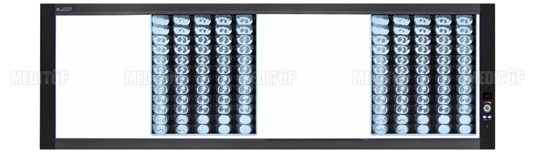 Máy đọc phim X-Quang 4 phim