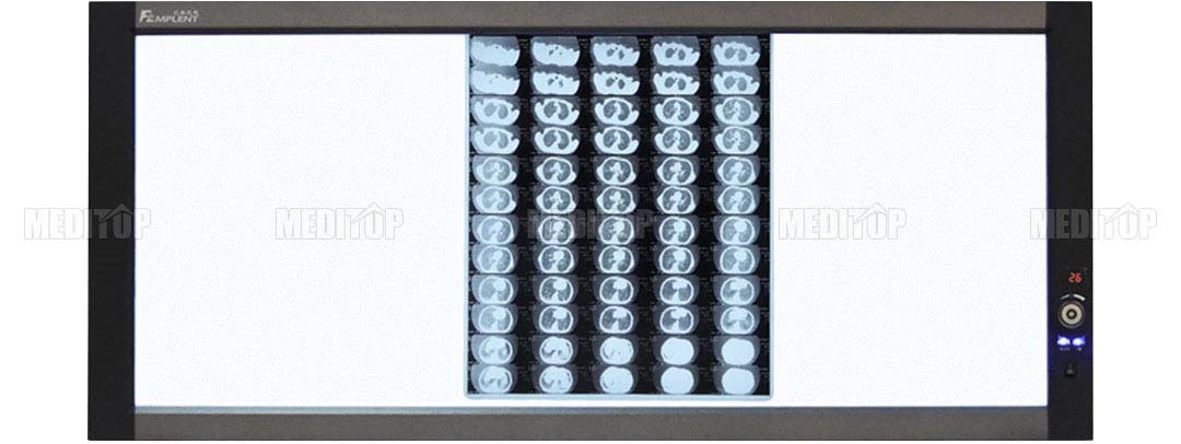 Máy đọc phim X-Quang 3 phim