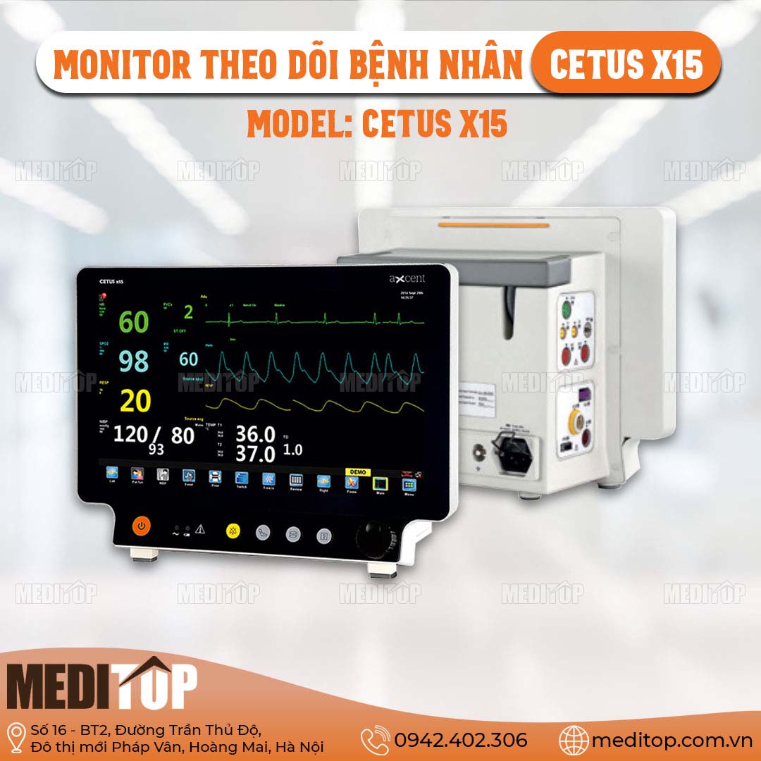 Monitor Cetus X15