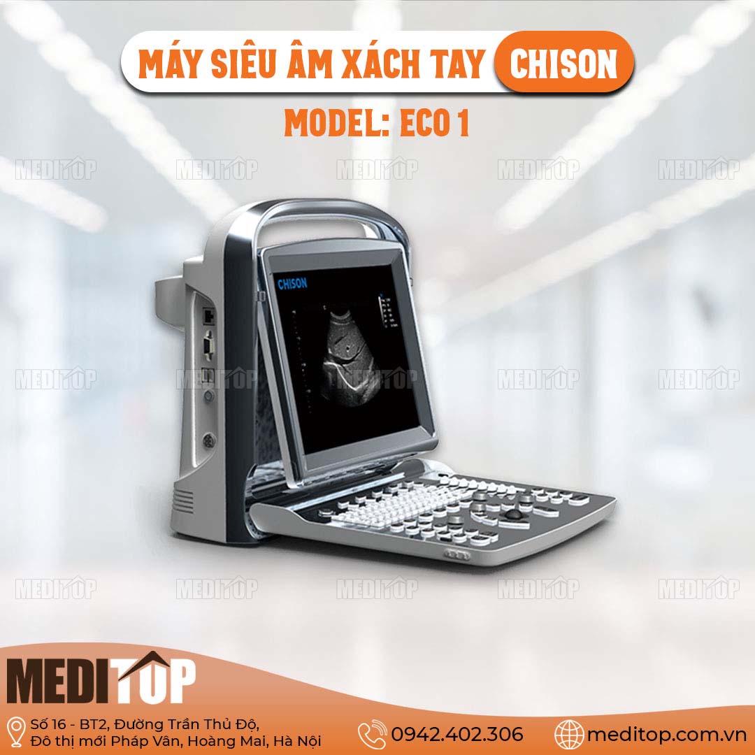 Máy siêu âm xách tay