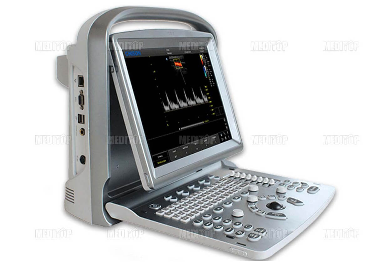  Phân loại máy siêu âm phổ biến theo chuyên khoa ứng dụng