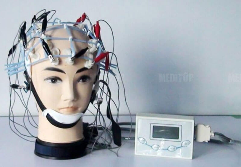 Giới thiệu điện não đồ 