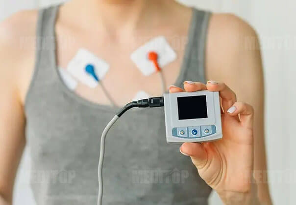 Phương pháp holter điện tim