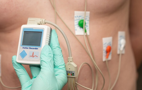 Quy trình thực hiện Holter điện tim
