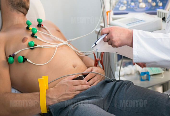Phát hiện rối loạn nhịp tim