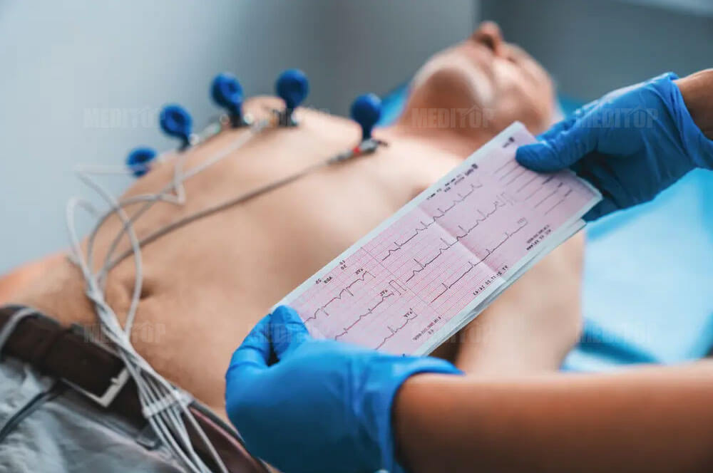 Chẩn đoán bệnh thiếu máu cơ tim