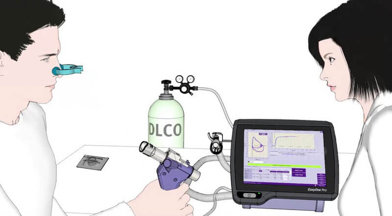 Các chỉ số quan trọng trong đo chức năng hô hấp DLCO