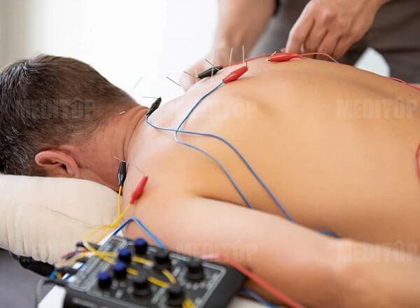Máy điện châm để bàn & treo tường cố định