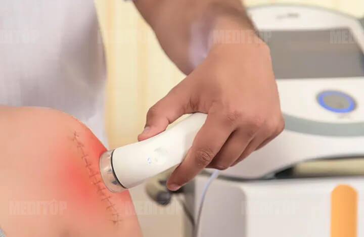 máy siêu âm điều trị da liễu – thẩm mỹ