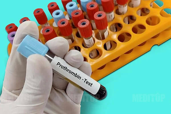 Xét nghiệm Prothrombin Time