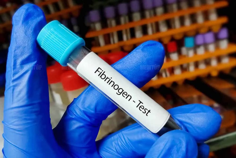 Định lượng Fibrinogen