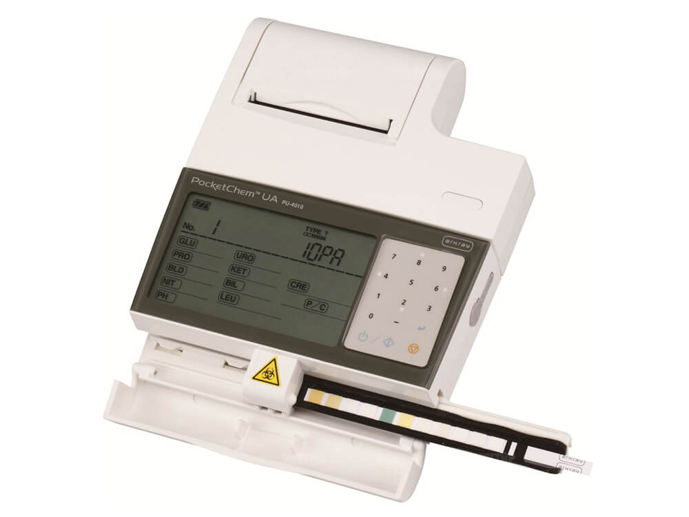 Máy phân tích cặn nước tiểu (Urine sediment analyzer)