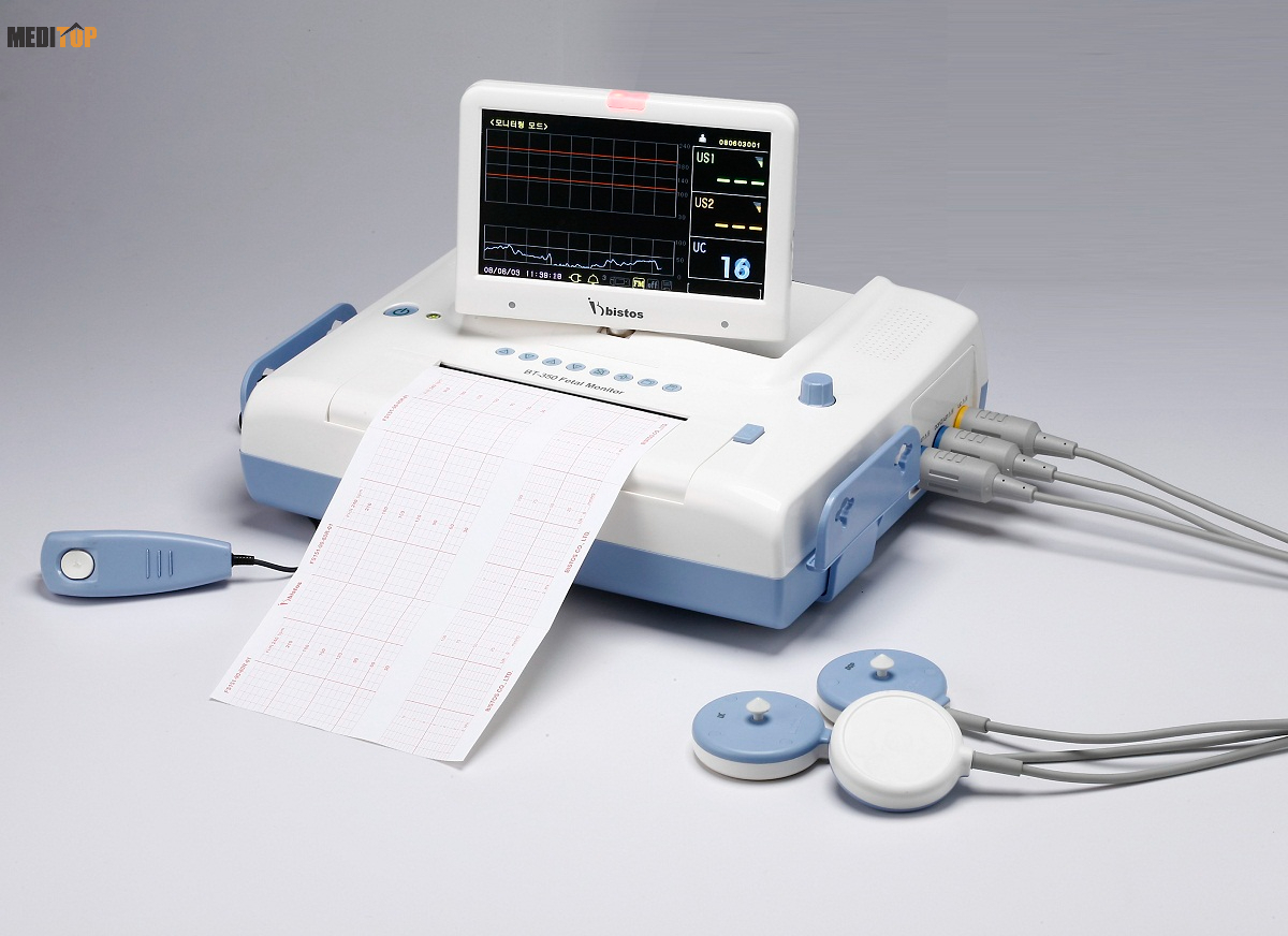 Đo monitor tim thai giúp phát hiện những vấn đề gì về sức khỏe của thai nhi và người mẹ?
