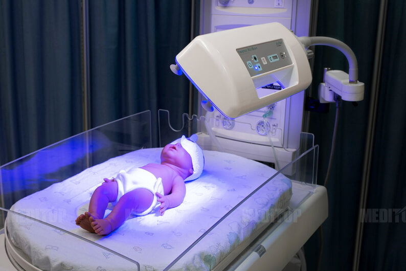 Nguy&ecirc;n nh&acirc;n g&acirc;y v&agrave;ng da ở trẻ sơ sinh