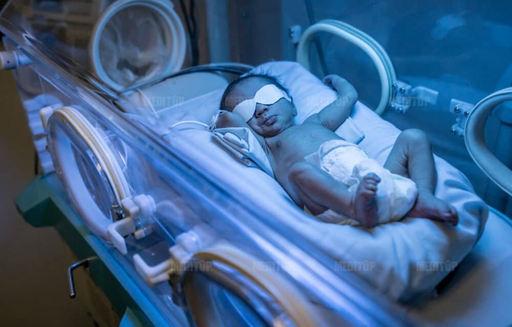 C&aacute;c loại đ&egrave;n chiếu v&agrave;ng da phổ biến