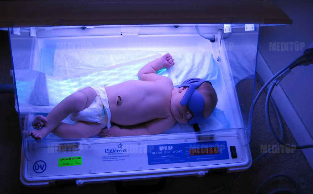 Lợi &iacute;ch chiếu đ&egrave;n v&agrave;ng da cho trẻ sơ sinh