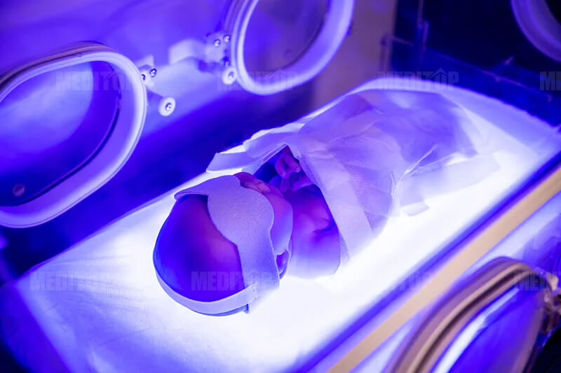 Quy tr&igrave;nh chiếu đ&egrave;n v&agrave;ng da cho b&eacute;