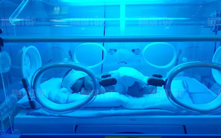 Sự ph&aacute;t triển của đ&egrave;n chiếu v&agrave;ng da