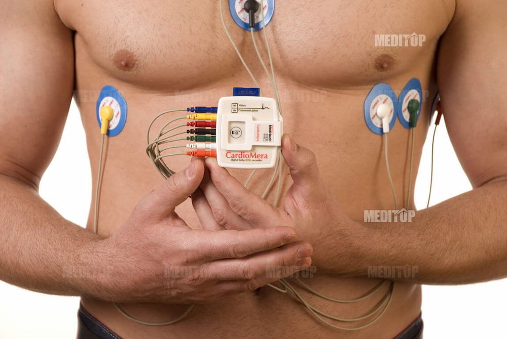 Giới thiệu về Holter điện t&acirc;m đồ