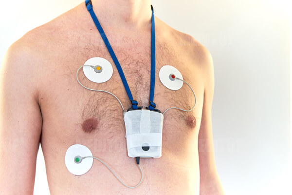 Ưu điểm nổi bật của m&aacute;y Holter điện t&acirc;m đồ trong chẩn đo&aacute;n tim mạch