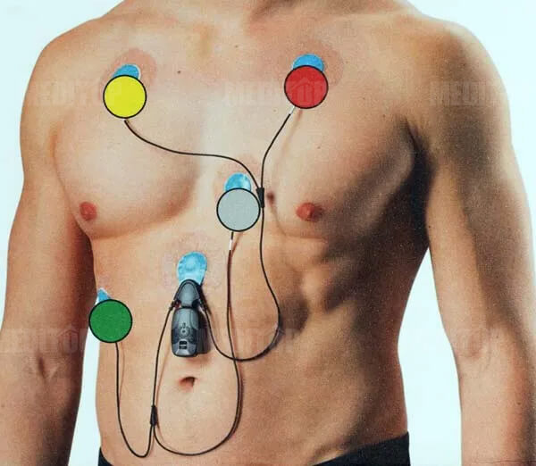 Vai tr&ograve; của m&aacute;y Holter điện t&acirc;m đồ trong xu hướng y tế hiện đại
