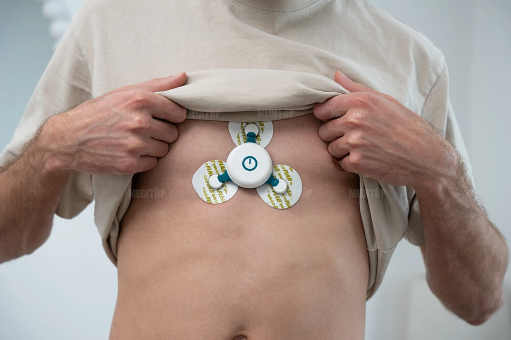 Holter điện t&acirc;m đồ trong y tế hiện đại