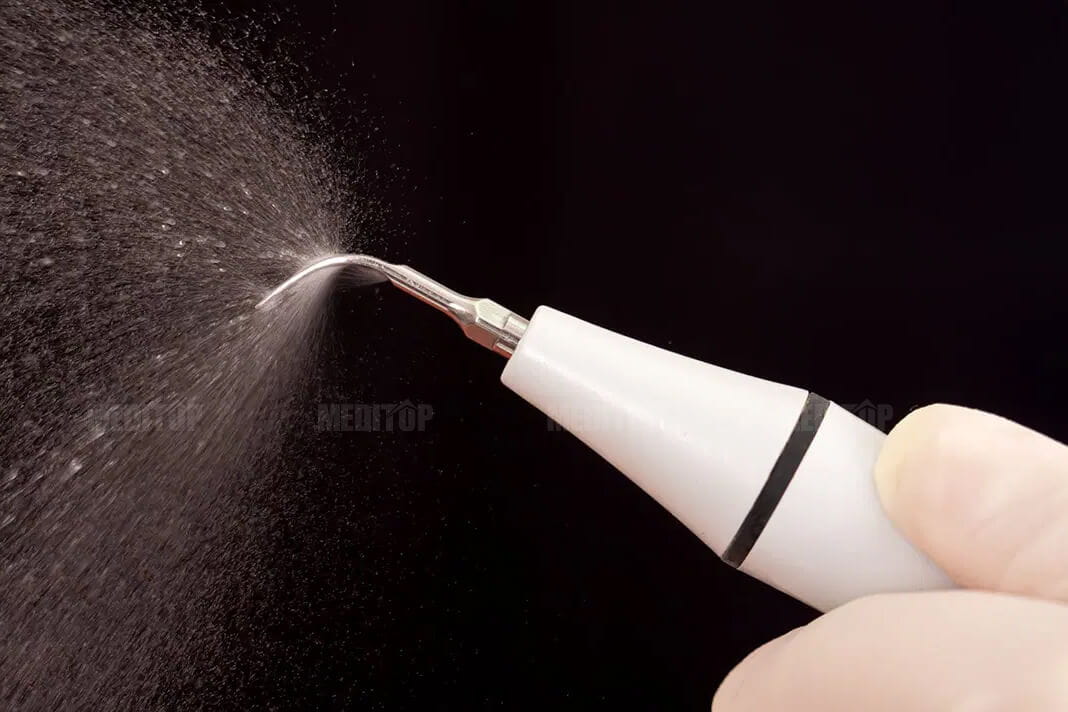 Lợi &iacute;ch d&agrave;i hạn của việc cạo v&ocirc;i răng định kỳ