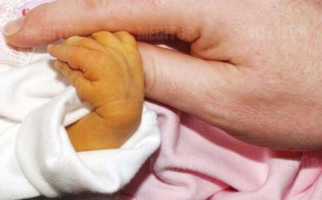 V&agrave;ng da sơ sinh v&agrave; tầm quan trọng của việc theo d&otilde;i