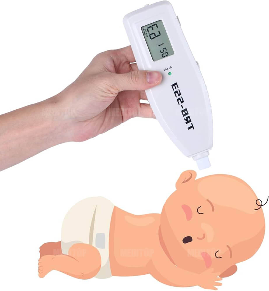 M&aacute;y đo bilirubin qua da l&agrave; g&igrave;