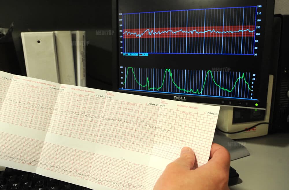 Giới thiệu về giấy in monitor theo d&otilde;i sản khoa