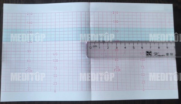 Ghi lại dữ liệu thai nhi li&ecirc;n tục