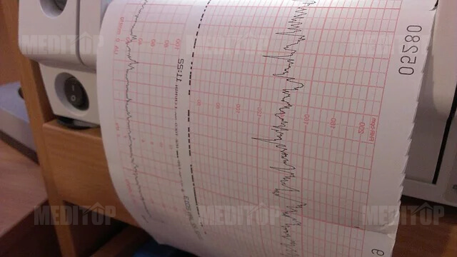 Giấy In Monitor GE Healthcare