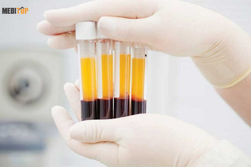 Sản xuất và bảo quản huyết tương đông lạnh