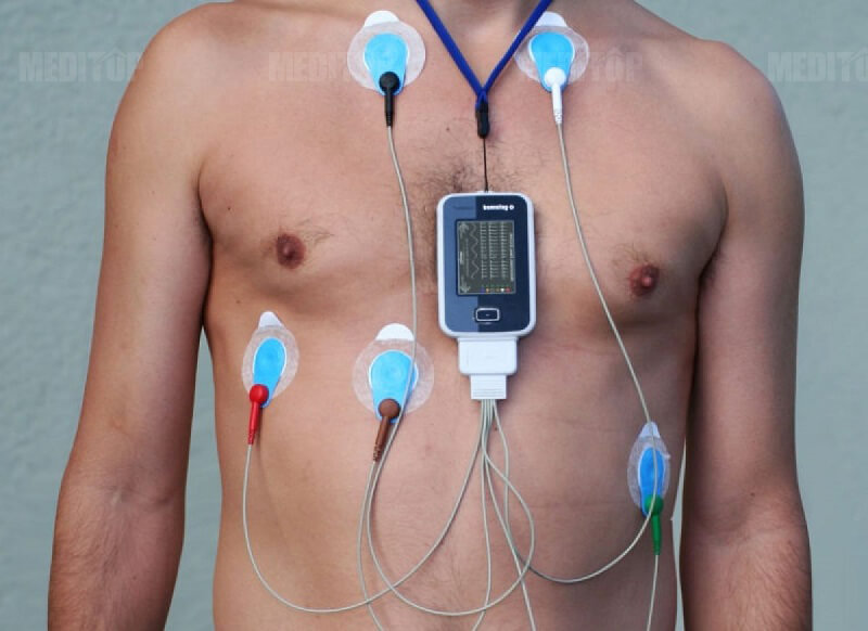 Holter điện tim