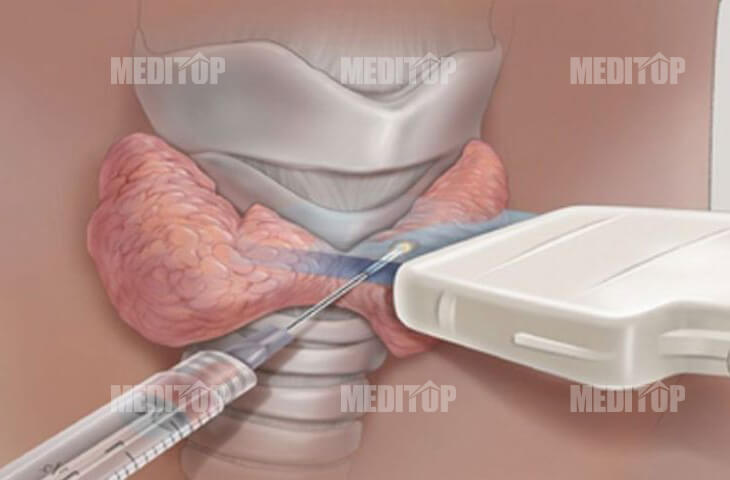 Nguyên lý hoạt động của máy đốt sóng cao tần