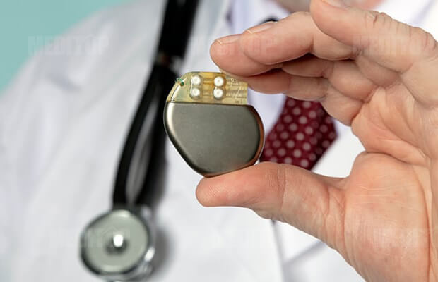 Máy trợ tim không dây