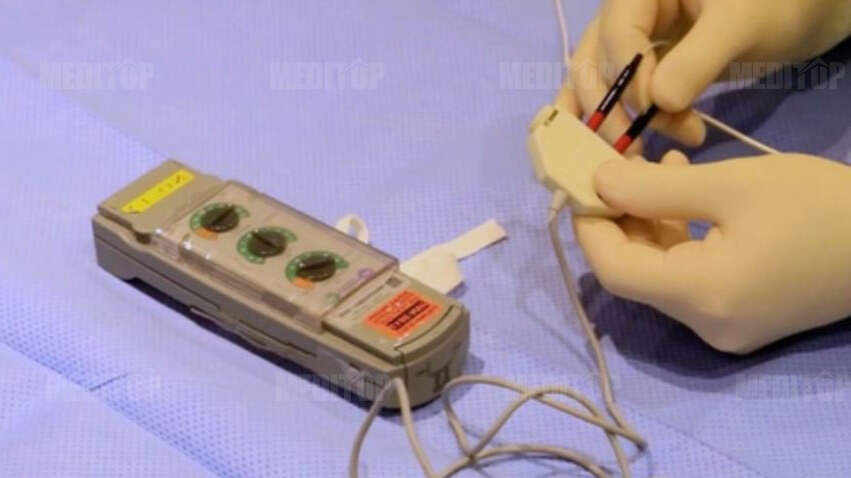 Máy trợ tim tạm thời