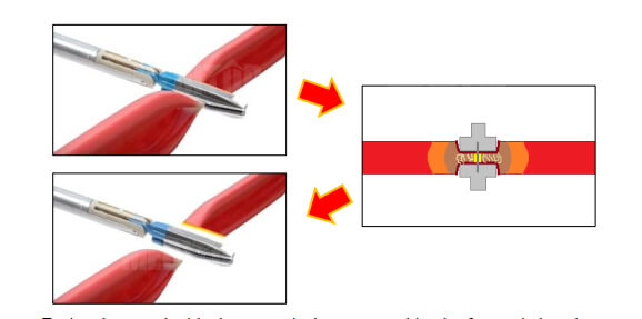 Các chế độ hoạt động của dao mổ ZEUS PRIME