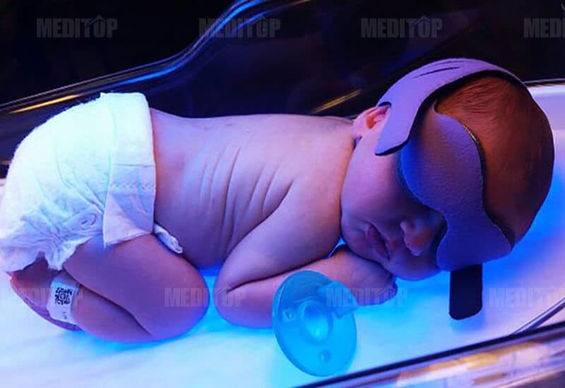 Giới thiệu đ&egrave;n chiếu v&agrave;ng da