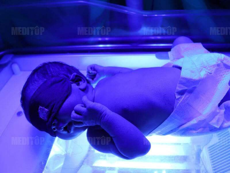 Hiểu r&otilde; về v&agrave;ng da ở trẻ sơ sinh