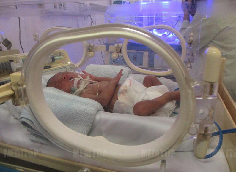 V&igrave; sao trẻ sơ sinh cần được chăm s&oacute;c bằng lồng ấp