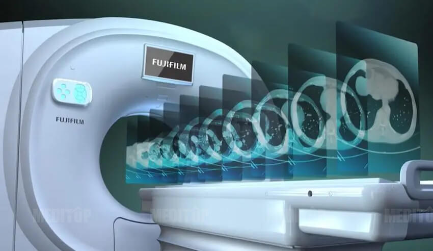 Dịch vụ chụp CT