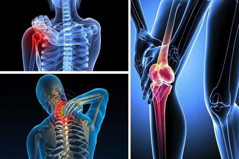 Đối tượng không nên sử dụng giường kéo giãn cột sống