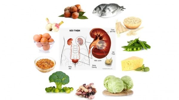 Chế độ ăn uống cho bệnh nhân sỏi đường tiết niệu