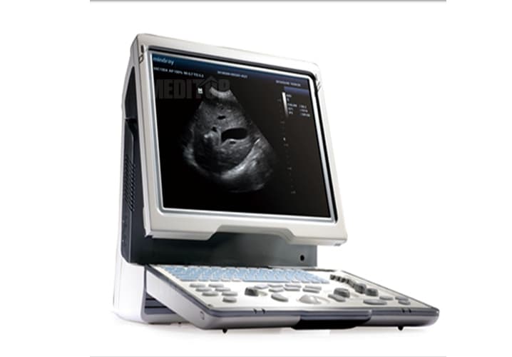 máy siêu âm DP-50
